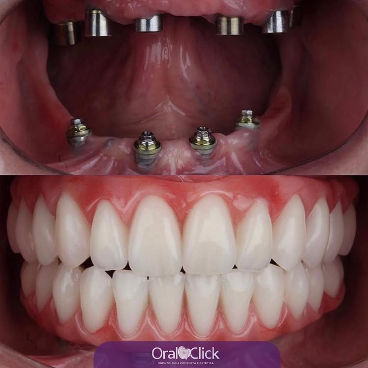 Captura de tela 2025-04-25 150134